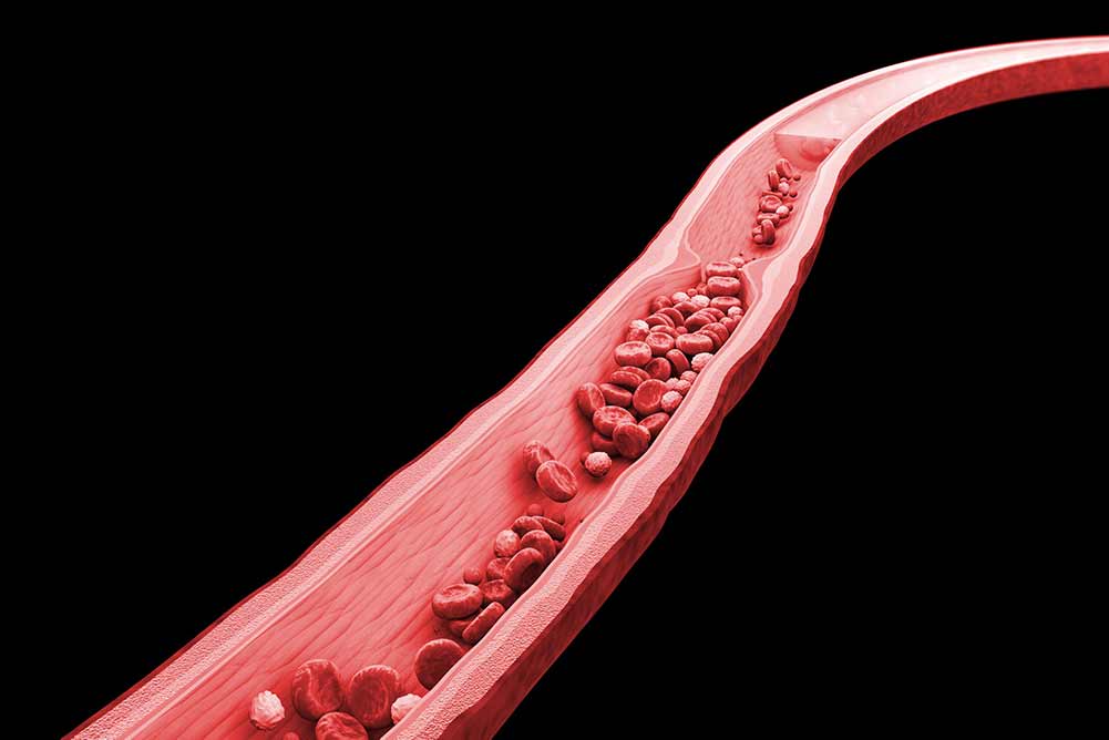 3d-rendering rote und weiße blutkörperchen in der vene