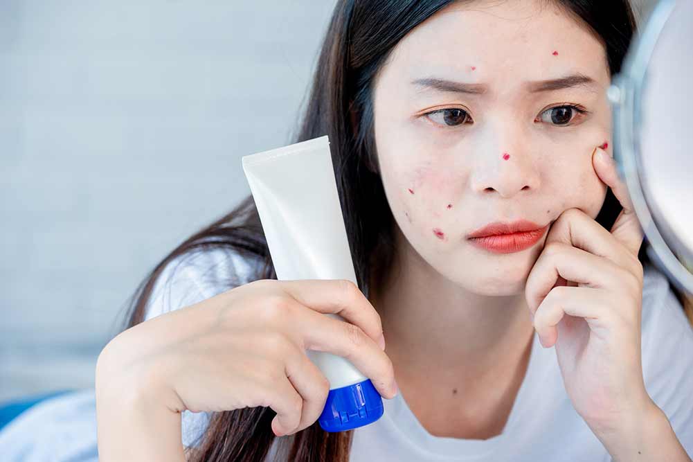 Asiatische teenager-frau, die spiegel betrachtet und akne-problem auf ihrem gesicht zusammendrückt, hautpflegekonzept.